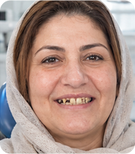 لبخند مراجعه‌کننده کلینیک رامیار